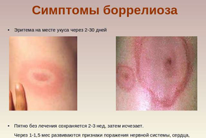 Особенности болезни Лайма - проявления на коже